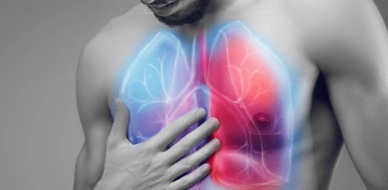 正元堂结减：较大的肺结节是肺癌吗？