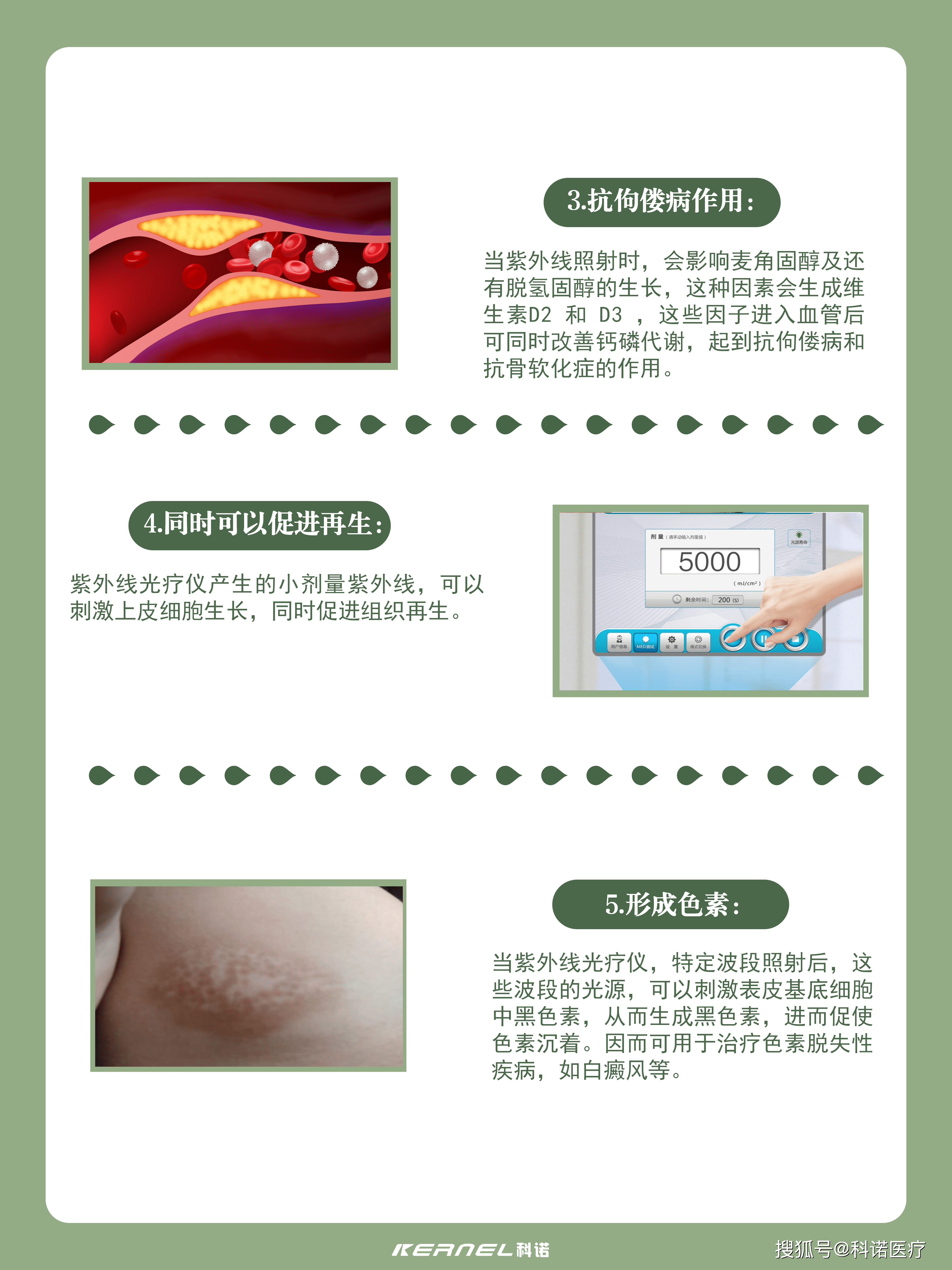 紫外线光疗仪会带来什么效果?-搜狐大视野-搜狐新闻