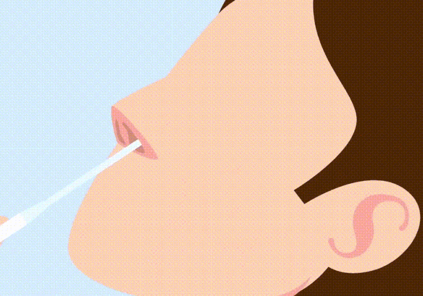 原创
            抗原检测盒是什么原理？