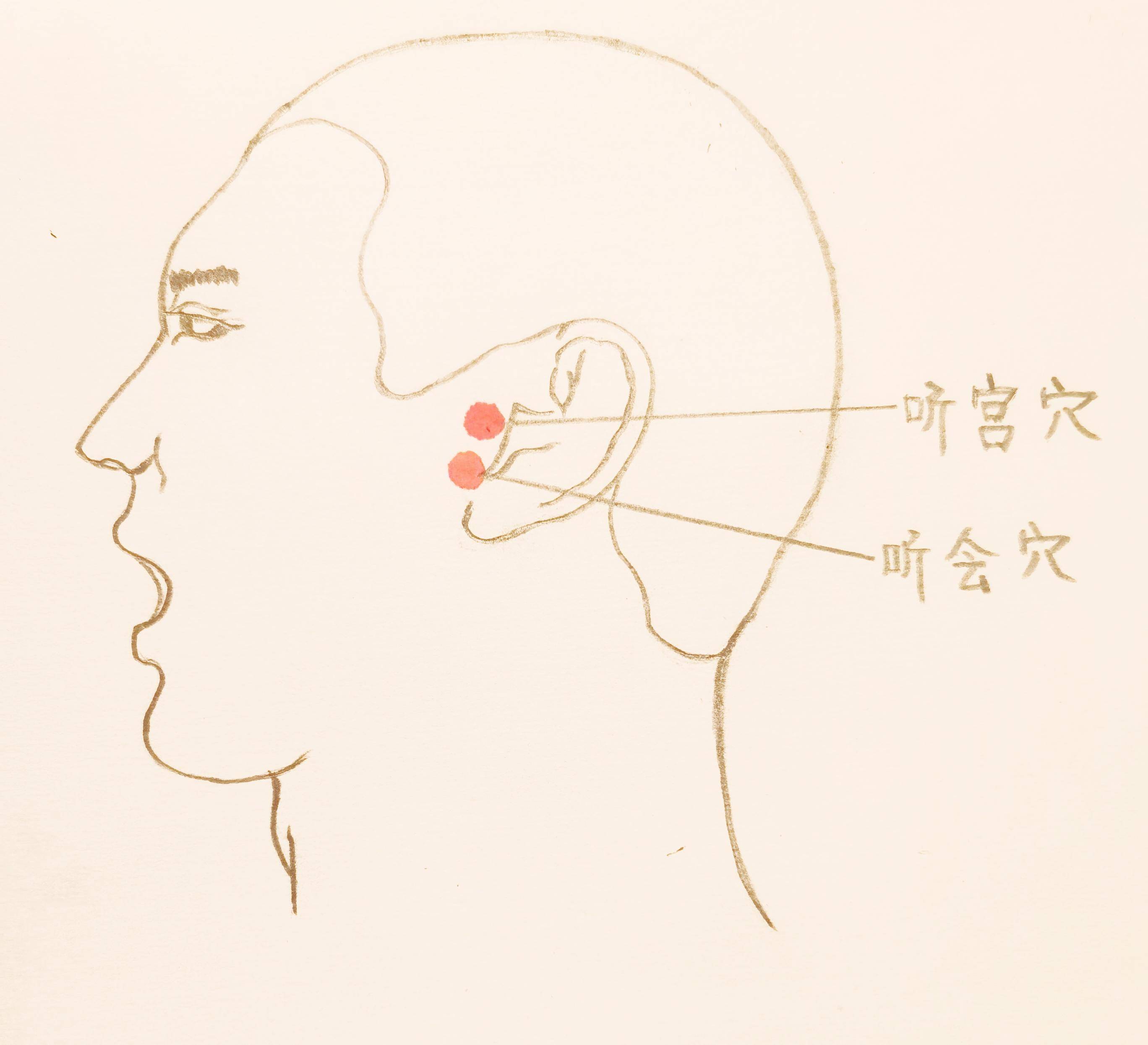 听宫穴 听宫穴位于手太阳小肠经上