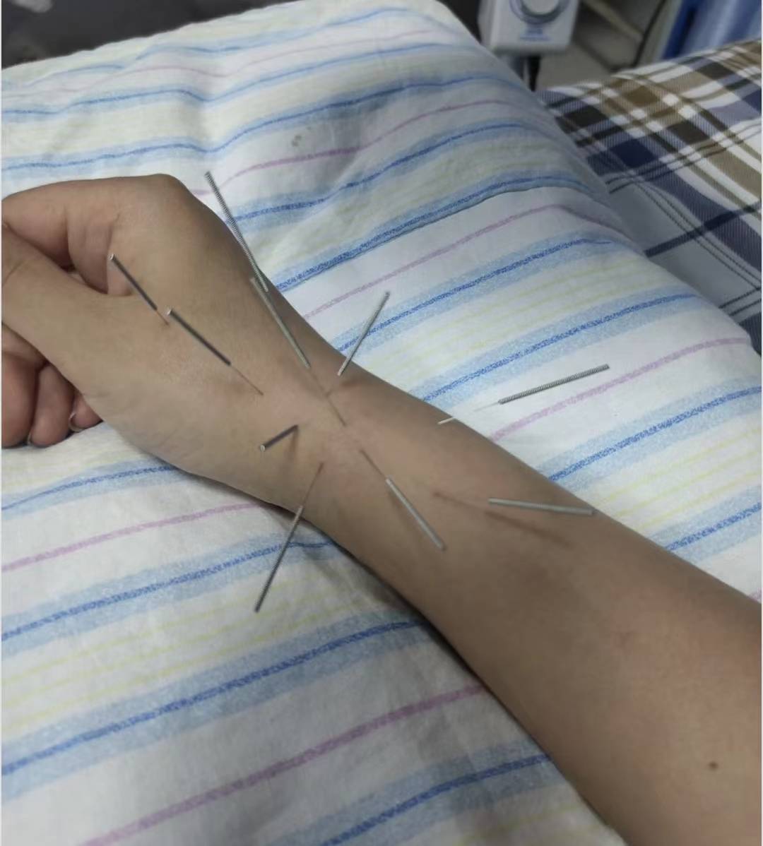 小心惹来腱鞘炎!_手指_关节_拇指