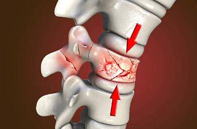 该怎么进行恢复?_治疗_患者_严重