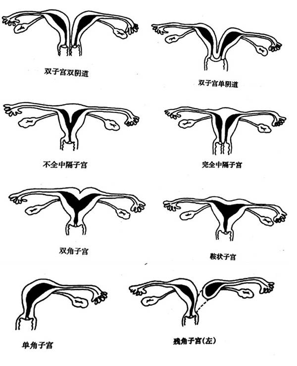 怀孕子宫形状图片