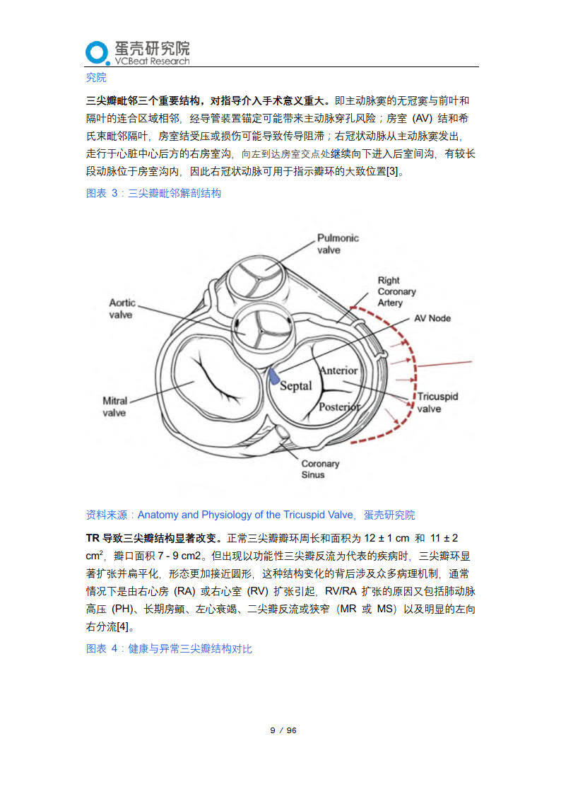 2023经导管三尖瓣介入治疗行业报告—三尖瓣不再被遗忘,中国创新闪耀