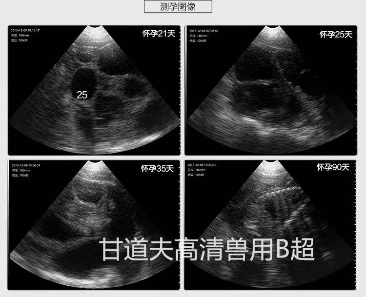 孕早期b超图解孕囊图片