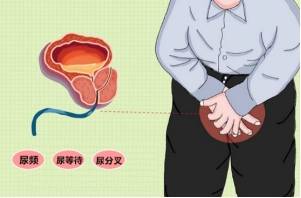 膀胱炎有什么症状早期图片