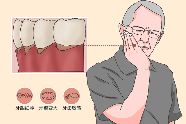 口腔_方法_表面