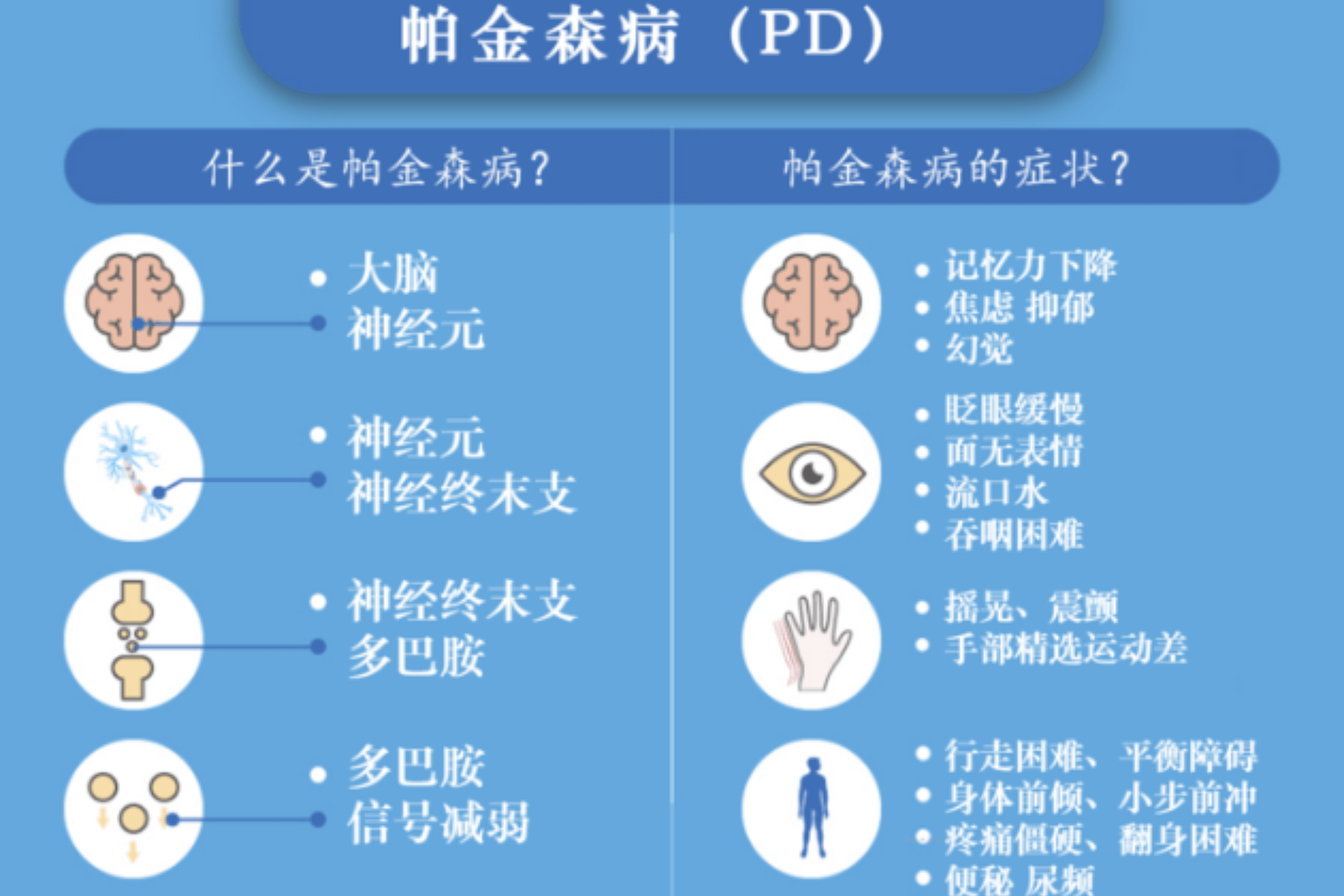 帕金森病的病因