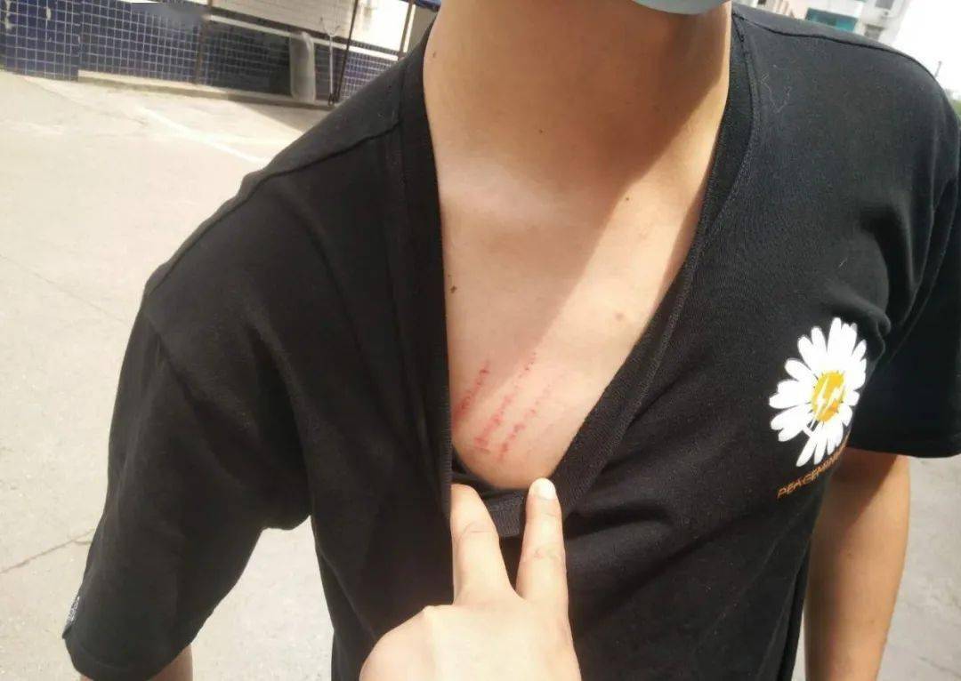 绵阳一男子离婚后仍被"家暴"