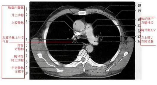 胸壁肌肉解剖ct横断面图片