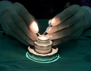 你是我的眼_角膜