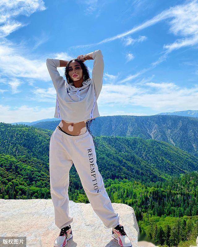 库兹马女友拍摄运动大片,白癜风超模自信非凡,成为时尚新宠儿