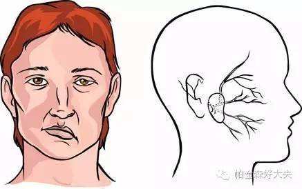 患者|眼睑痉挛的治疗方法和临床表现