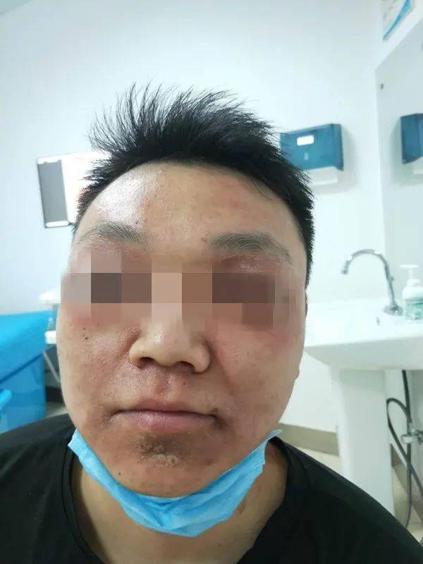 这个虫不能随便拍,转发提醒_皮肤