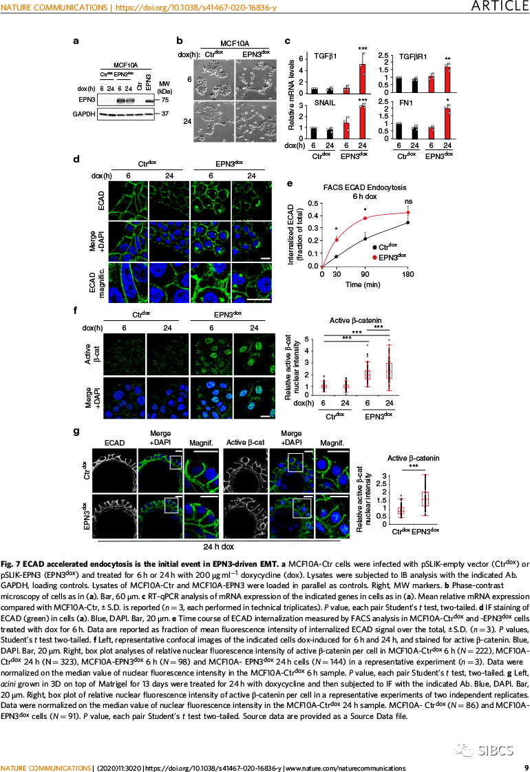 科学家发现乳腺癌细胞内吞促转移靶点_pilcher