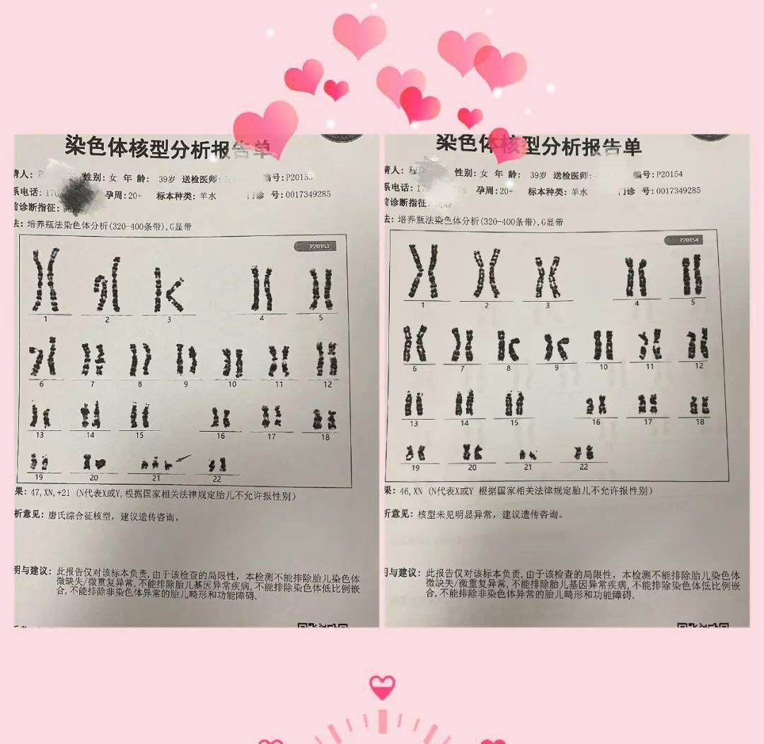 【吐露"新生"系列37】双胎之一是唐氏儿,"娘家人"出面解难题