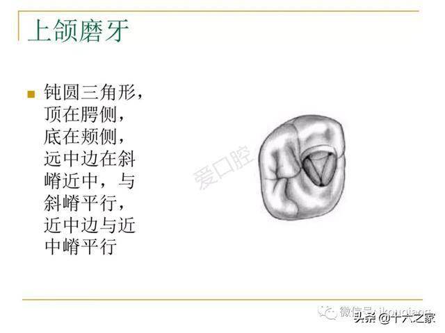 牙体髓腔解剖系统开髓开髓洞型及根管常用器械的认识和使用