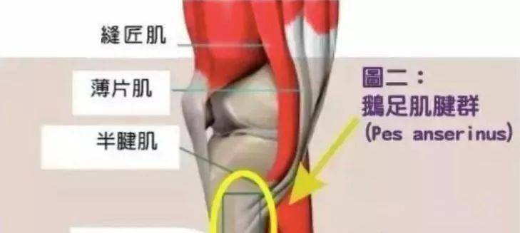 膝关节疼痛被忽视的疾病鹅足炎