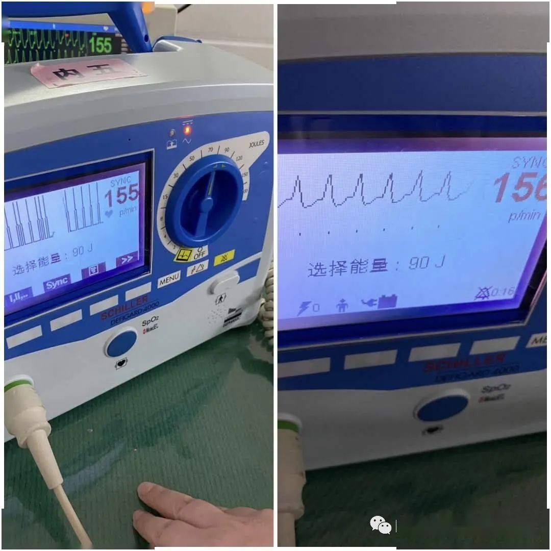 老年患者室速复律