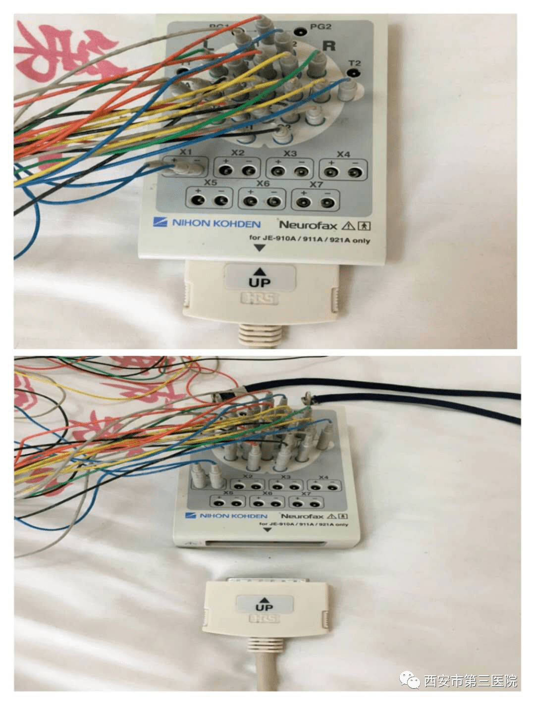 做脑电图检查时,大脑没有接受刺激,也不会对大脑施加任何外界干扰