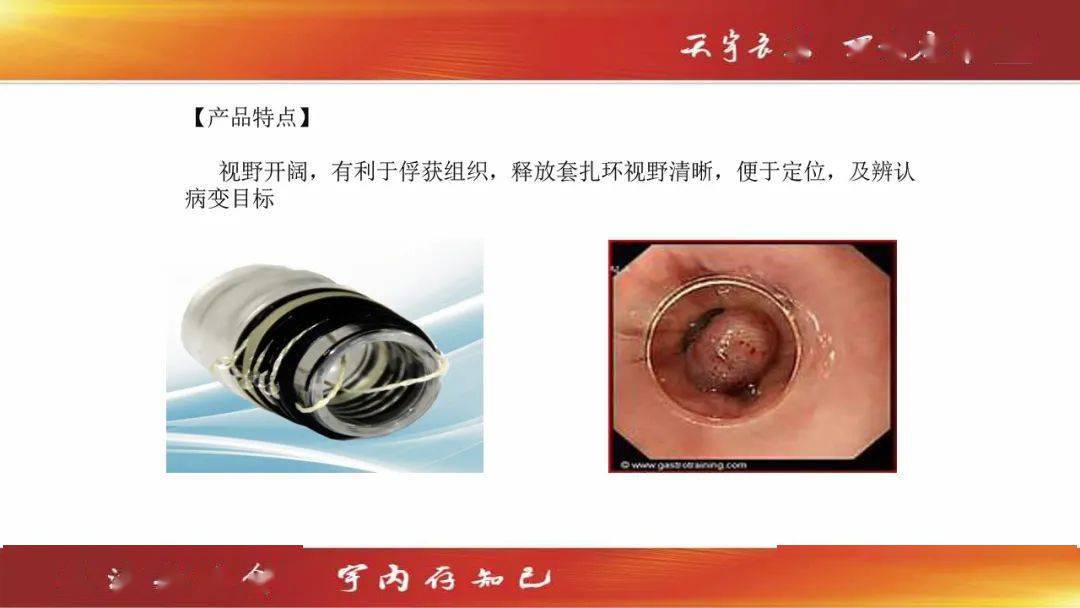 内痔套扎器】【医用透明粘膜吸套】【医用静脉曲张袜】呵护下肢健康