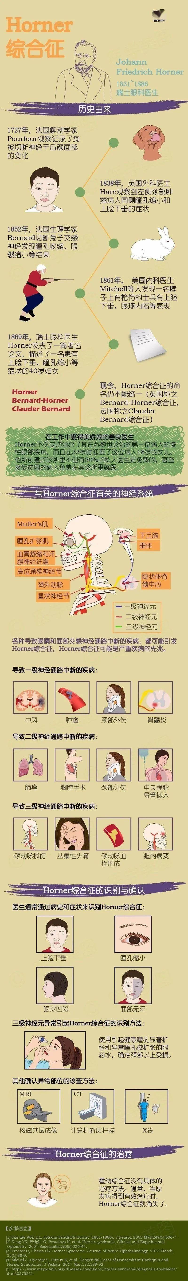 推荐一图读懂horner综合征