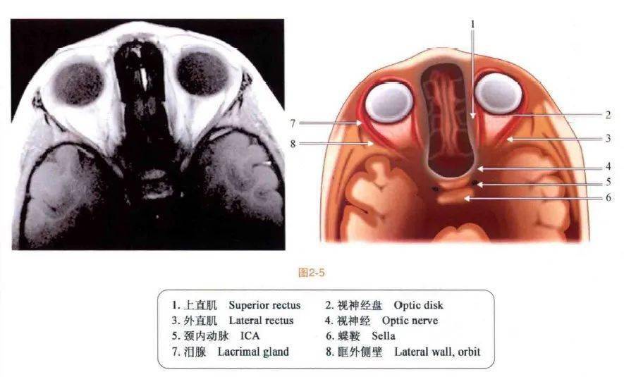 速查图谱眼眶mri断层解剖