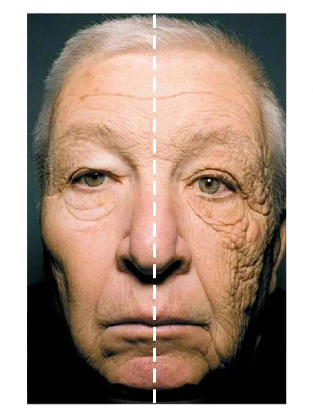 紫外线对我们皮肤的伤害我相信大家都很清楚了,这张防晒对比图肯定都