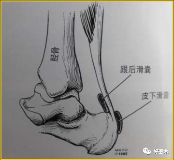 踝关节滑囊解剖图片