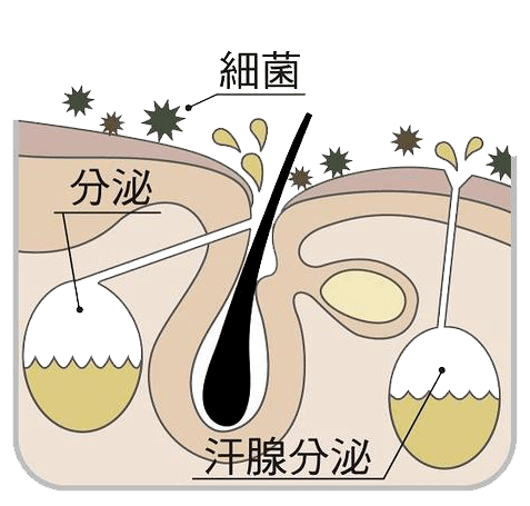 另一种是顶浆腺,又名大汗腺,它只有汗腺总数的10%,主要发布在腋下