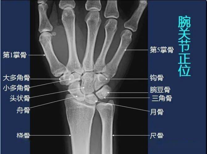 影像解剖全身常規x線骨關節mri斷層解剖大全