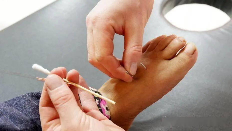 揭秘藏医独特的金针疗法