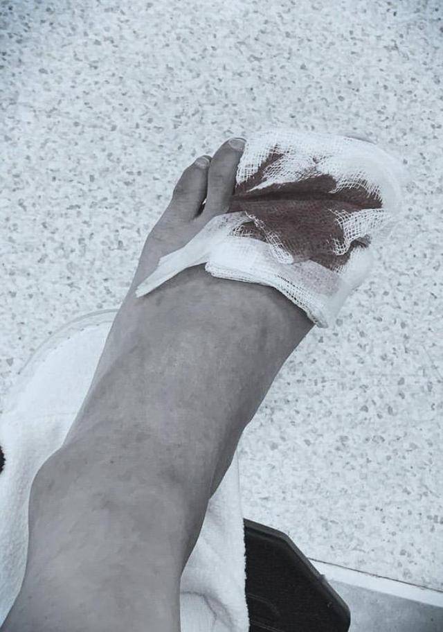 tvb小花新剧饰演高海宁助手反应真实意外受伤似血案现场