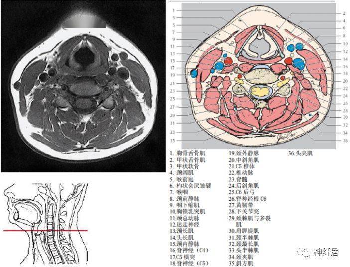 颈部详细的断层解剖