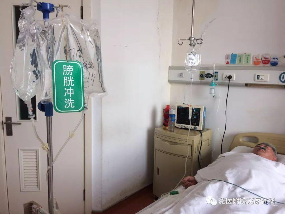 这是膀胱冲洗,目的是术