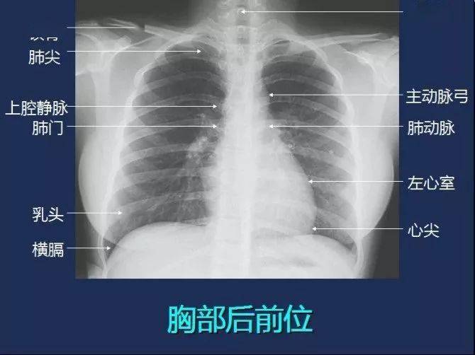 醫學必備人體各部位x線圖譜