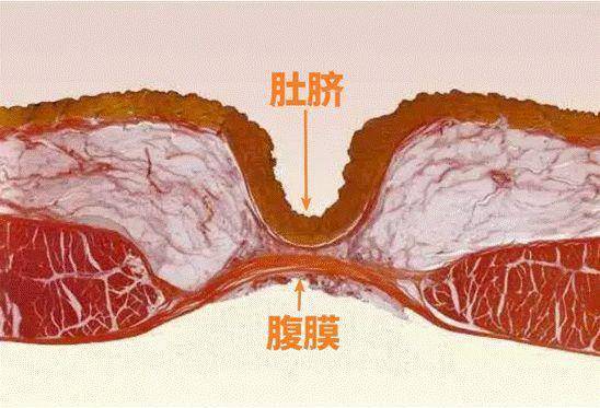 肚脐部解剖结构图图片