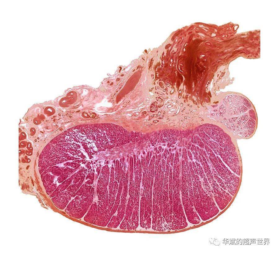 节段性睾丸梗塞令人尴尬的楔形