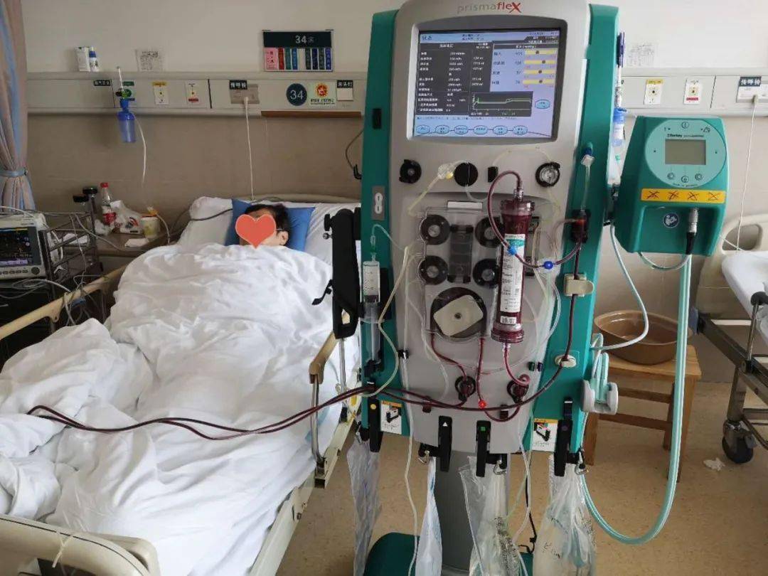 新闻嘉兴一院肾内科率先全市开展床边crrt治疗