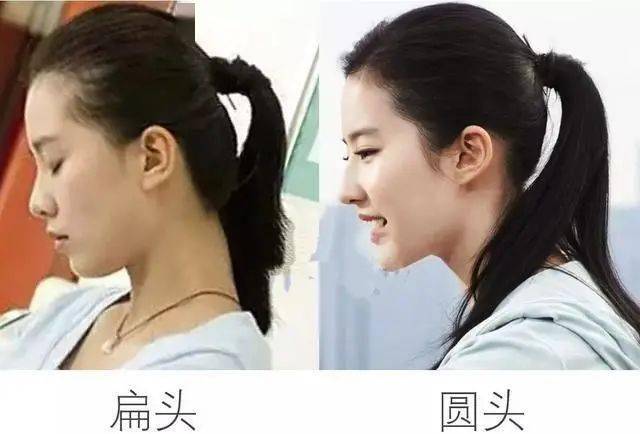 天天科普 | 小时候“睡扁”的头,现在还有救吗?_颅骨