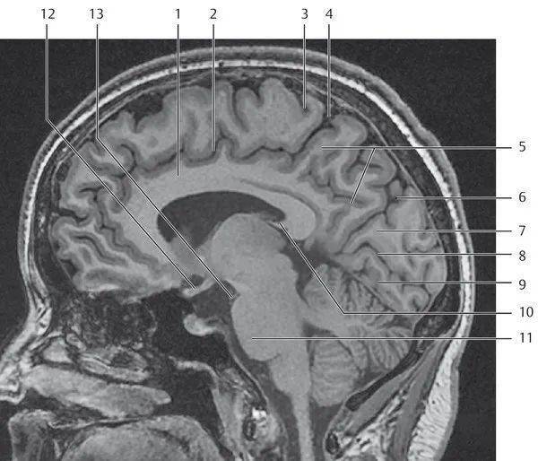 头颅磁共振解剖图图片
