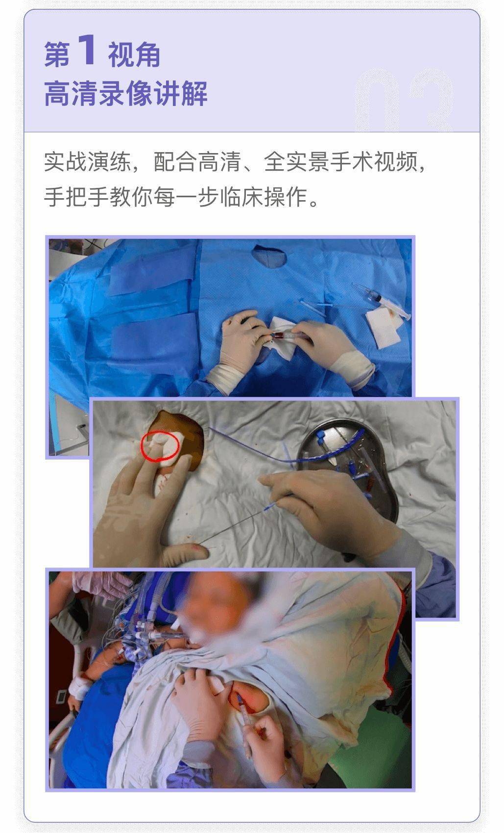 静脉塌陷误穿动脉深静脉穿刺三十六计全在这里了