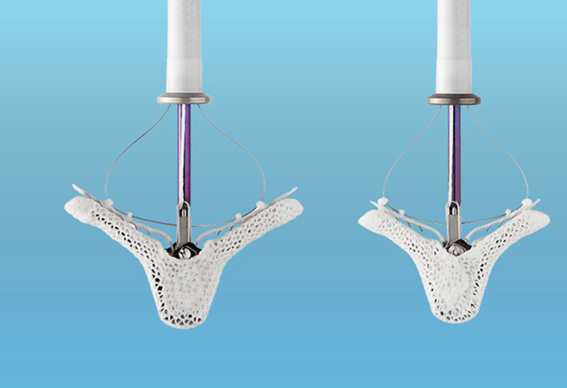 心脏夹持器雅培mitraclipg4收到ce标志批准
