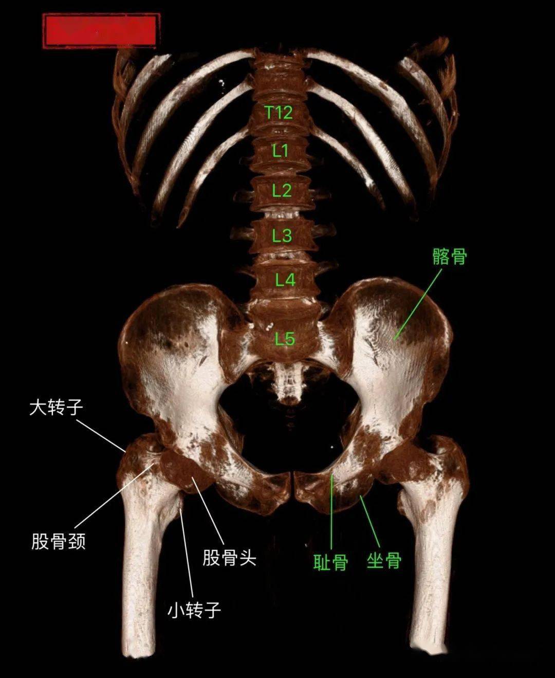 骨盆3d立体图图片