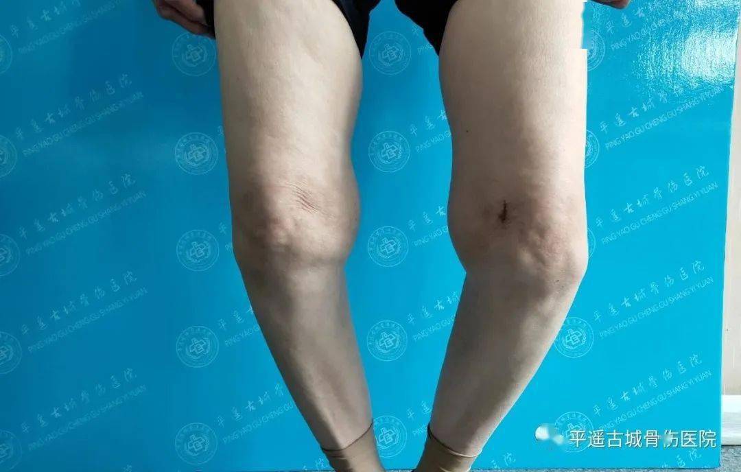 【健康义诊】为期一月的专家义诊活动正在进行时!_膝关节