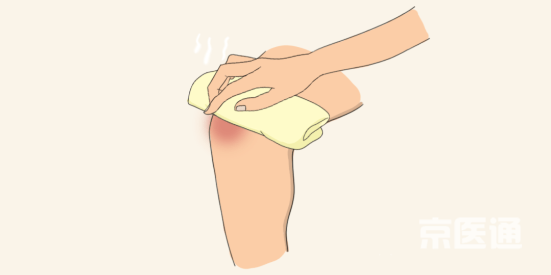 常见的10种情况,该热敷还是冷敷?