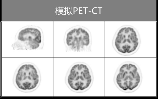 揭秘 | 听说PET-CT一扫，就能知道有没有肿瘤？-搜狐大视野-搜狐新闻