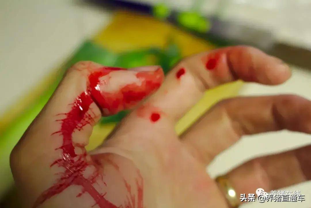 清洗猪肉时划破手指竟险些危及性命这个操作一定要注意