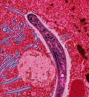 人肤蝇被蚊子感染上,会钻进人体内部变成蛆…帮大家打个码,真图更恶心