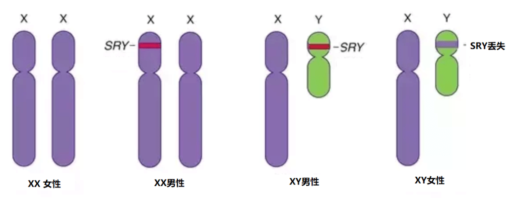 由此可见xy染色体携带者之所以能分化成男性,完全仰仗sox9基因蛋白